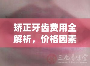 矫正牙齿费用全解析，价格因素一网打尽！