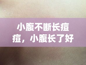 小腹不断长痘痘，小腹长了好多痘痘很痒 