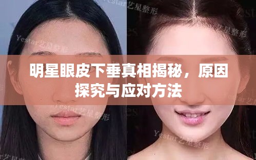 明星眼皮下垂真相揭秘，原因探究与应对方法