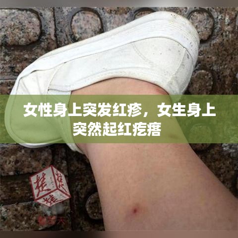 女性身上突发红疹，女生身上突然起红疙瘩 