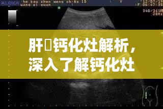肝內钙化灶解析，深入了解钙化灶成因与影响