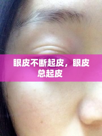 眼皮不断起皮，眼皮总起皮 