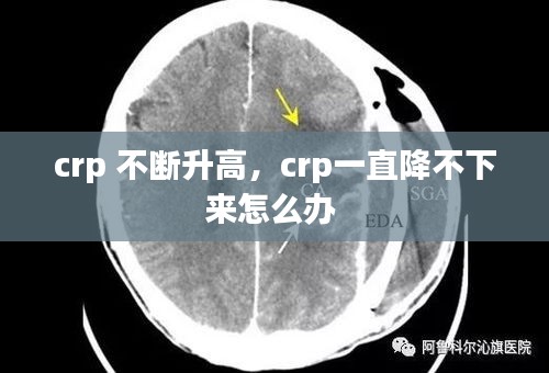 crp 不断升高，crp一直降不下来怎么办 