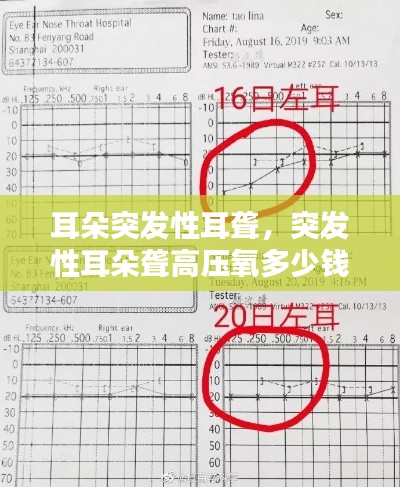 耳朵突发性耳聋，突发性耳朵聋高压氧多少钱 